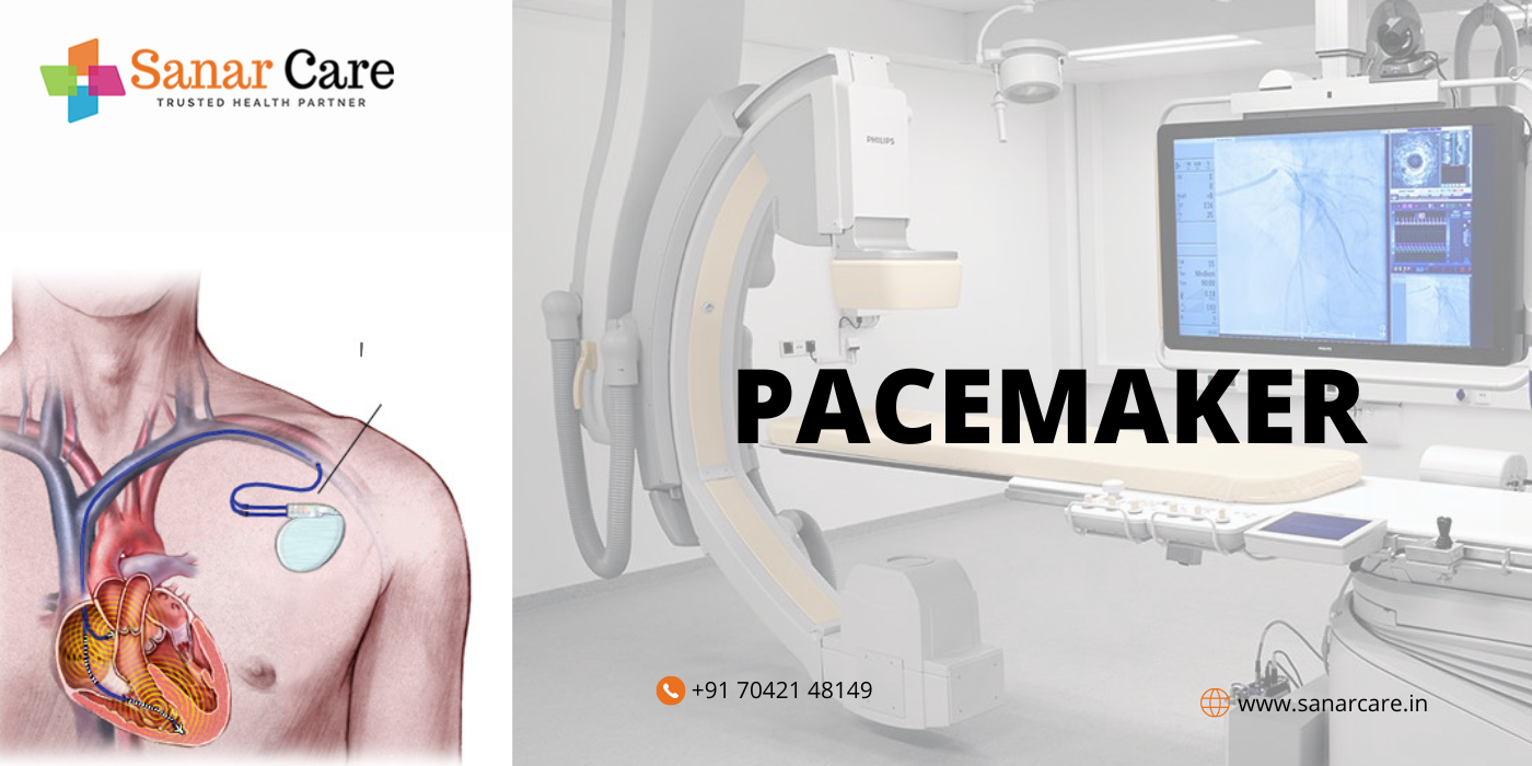 Pacemaker And MRI What Are They?