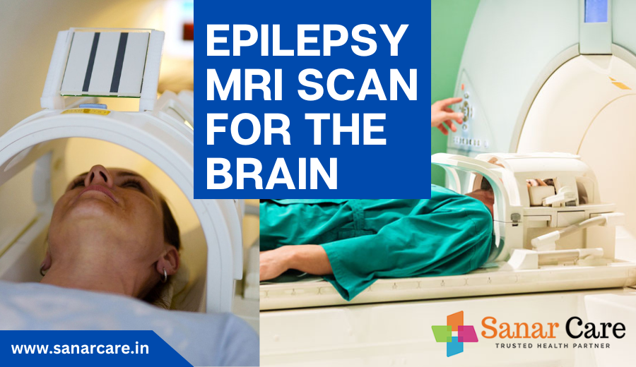 What is an epilepsy MRI scan for the brain? MRI Scan of the brain in Gurgaon