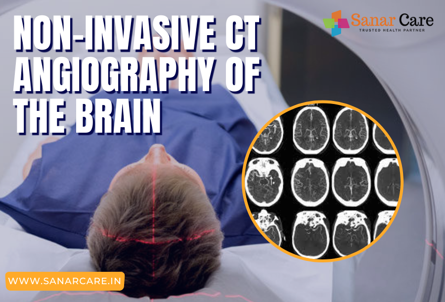 Non-invasive CT angiography of the brain in Gurgaon