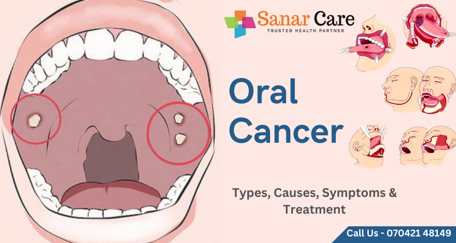 Oral Cancer | Types, Causes, Symptoms & Treatment