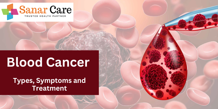 Blood Cancer - Types, Symptoms and Treatment 