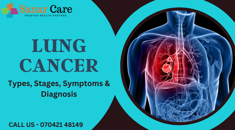 Lung Cancer - Types, Stages, Symptoms & Diagnosis