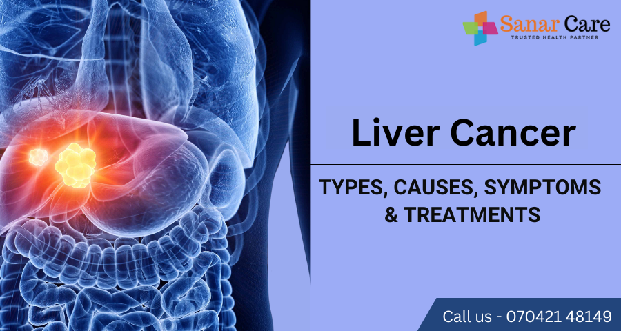 Liver Cancer | Types, Causes, Symptoms & Treatments
