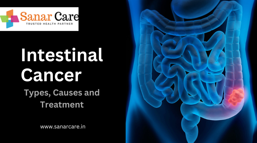 Intestinal Cancer